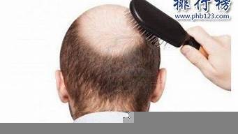 2024年脱发产品排行榜前十名 科学评测与选购指南